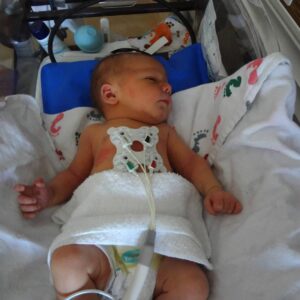Miracles happen; Rare birth story from a grateful mom (part 2)