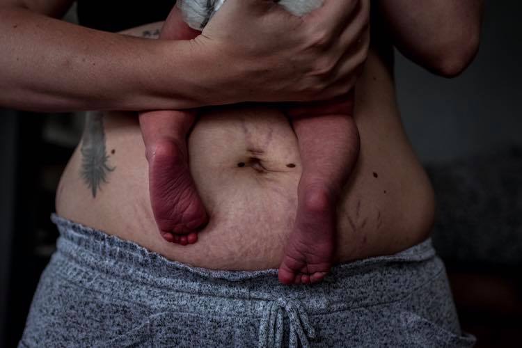 Newborn baby feet and postpartum stomach