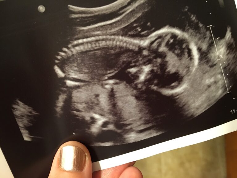 Woman holding ultrasound picture of baby