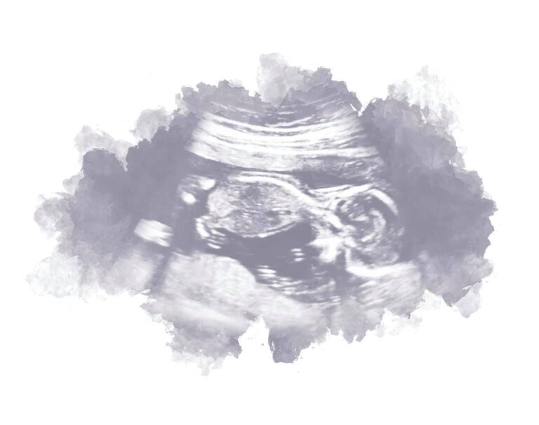 Black and white ultrasound artwork