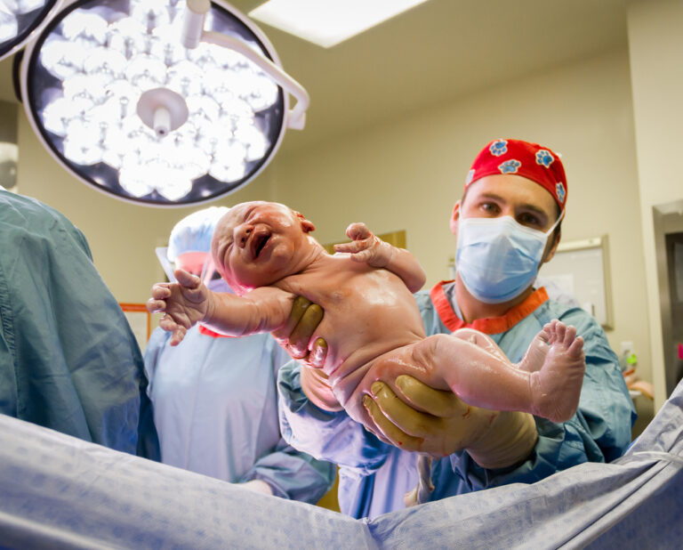 Doctor holds newborn baby C-section