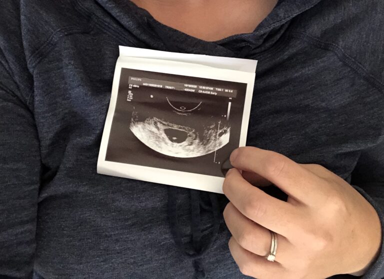 Ultrasound image miscarriage