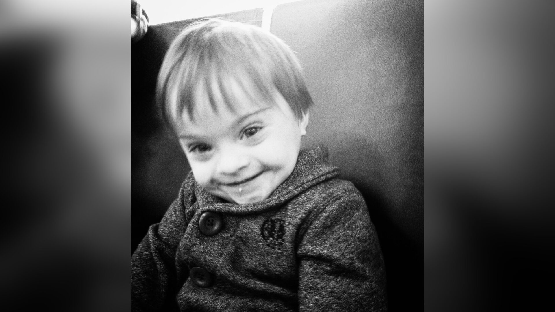 Toddler with Down syndrome smiling