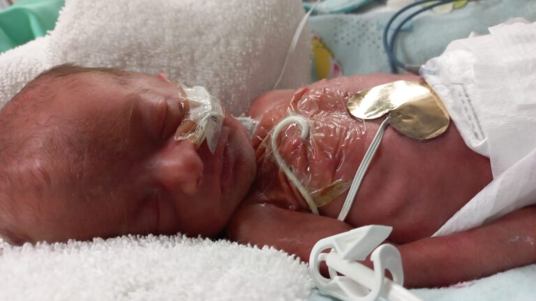 Premature baby in hospital with monitors, color photo