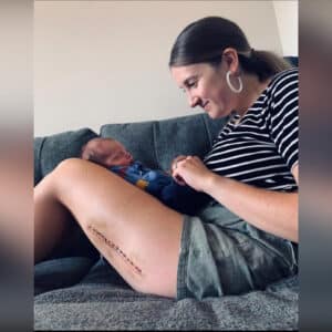 Motherhood and Melanoma: An Unexpected Journey