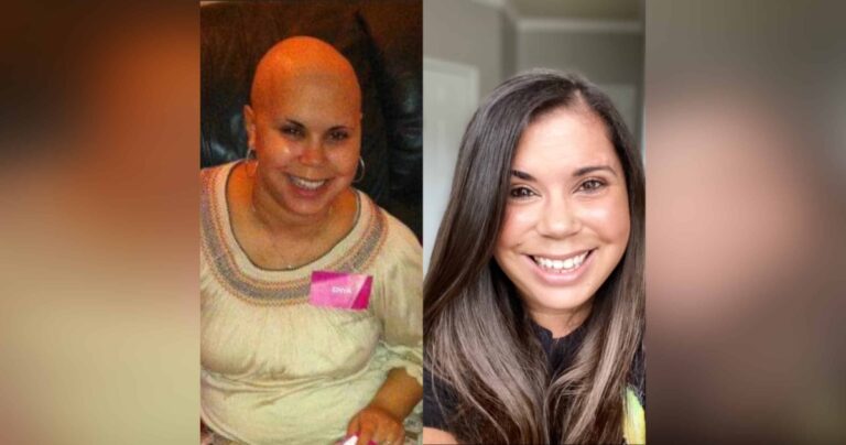 Bald woman during cancer treatments and same woman in remission, color photo