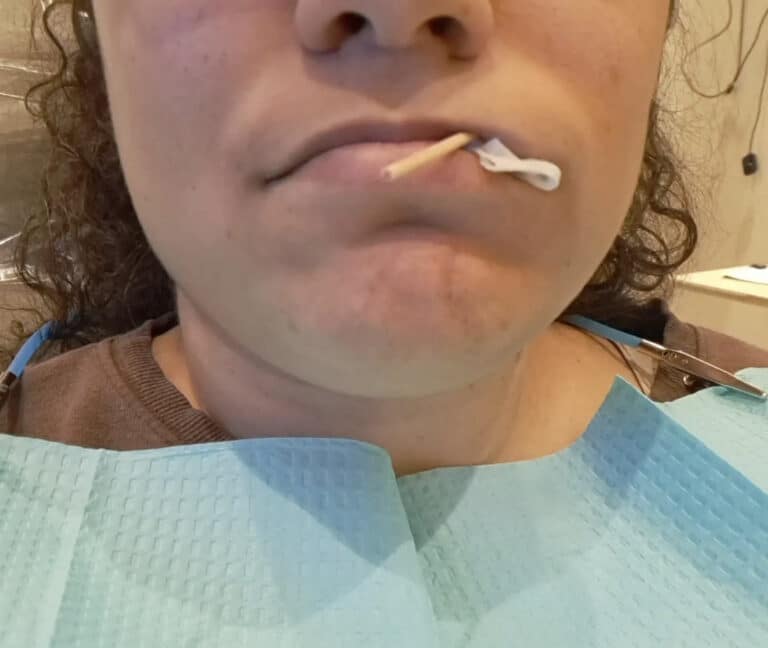 Woman in dentist office with gauze in her mouth, color photo