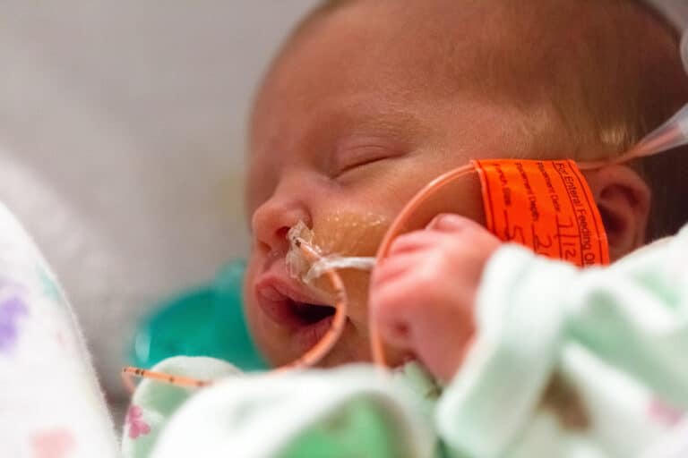 Closeup of baby in NICU with tube in nose